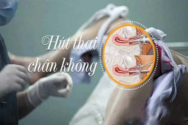 phá thai có đau không
