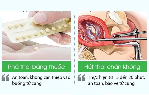 Phá thai bao nhiêu tiền