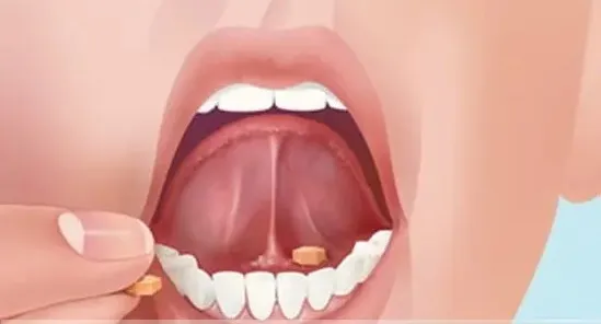 Thuốc phá thai misoprostol stella 200mcg